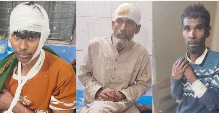 ইন্দুরকানীতে রাজনৈতিক সংঘর্ষের ঘটনায় আহতদের চিকিৎসা